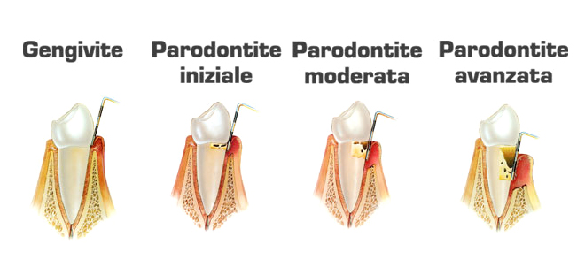 parodontologia